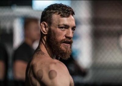 ventouses Connor Mc Gregor